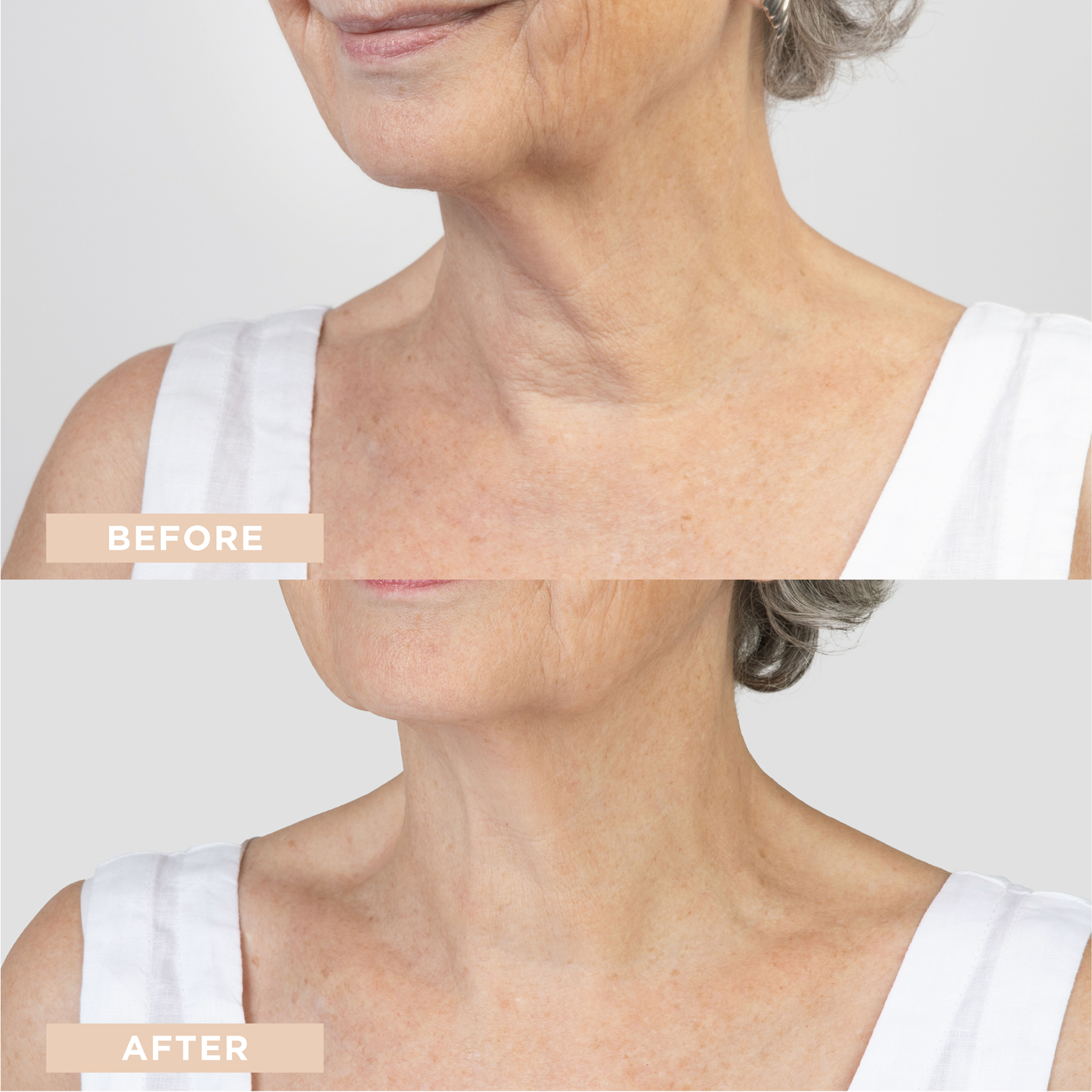 Neck + Décolleté Firming Cream - Day and Night