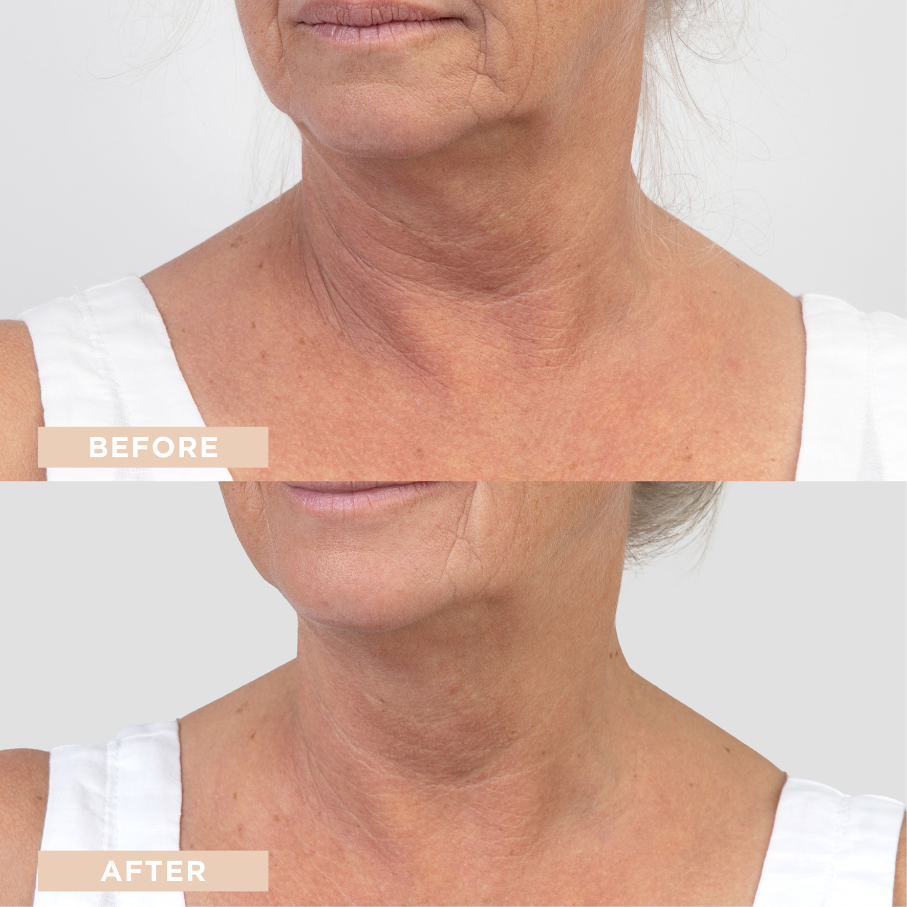 Revitalising Hyaluronic + B5 Booster Serum
